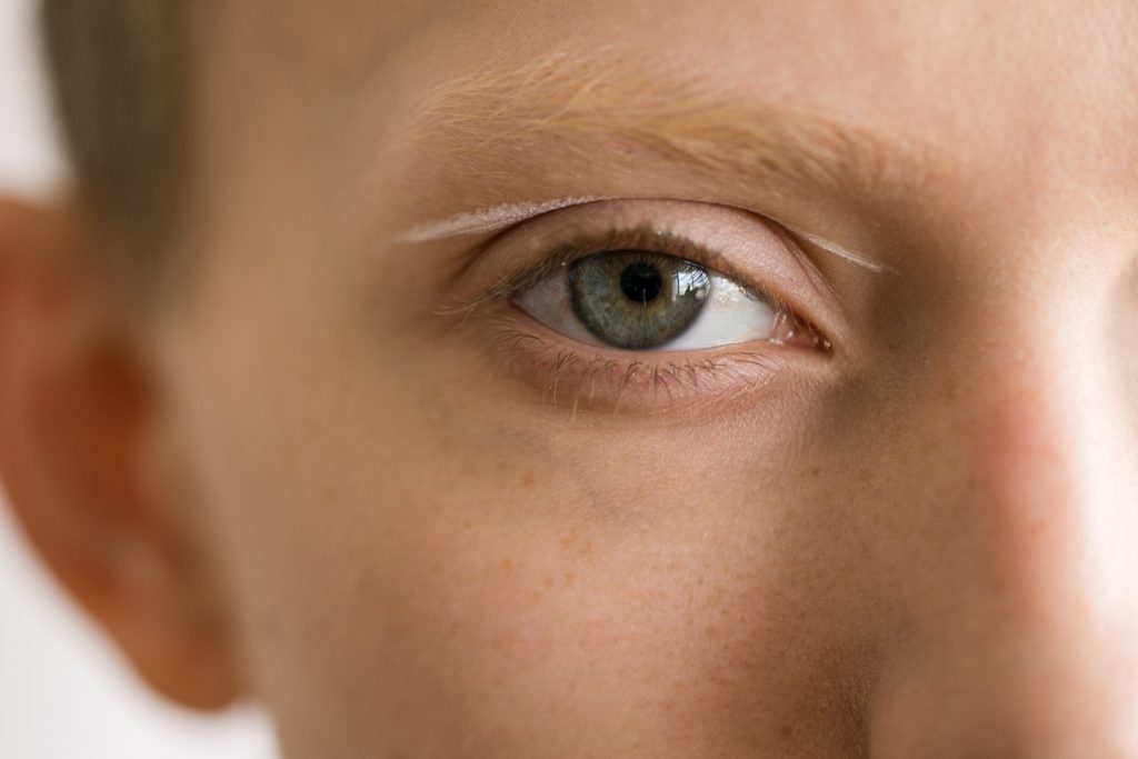 common-eye-diseases-brain-overflow-an-eye-doctors-blog